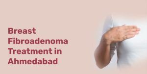 Breast Fibroadenoma Treatment in Ahmedabad